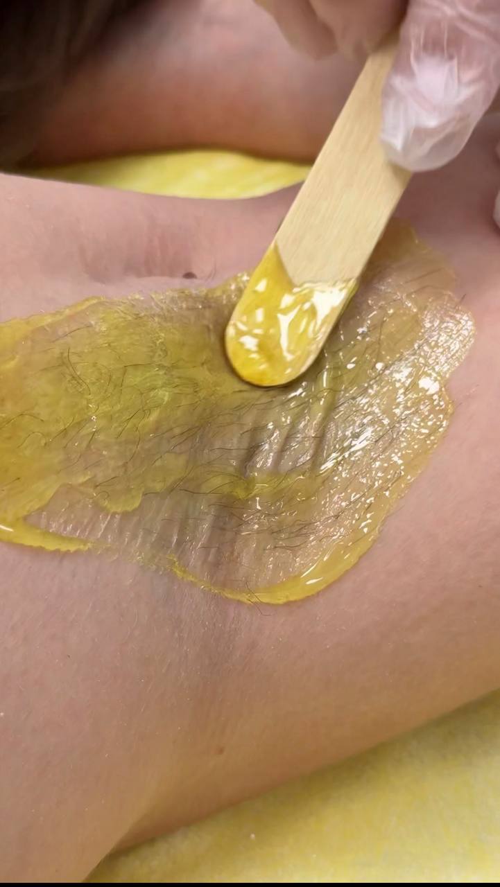 Auftragen von Zuckerpaste bei der Waxing-Behandlung